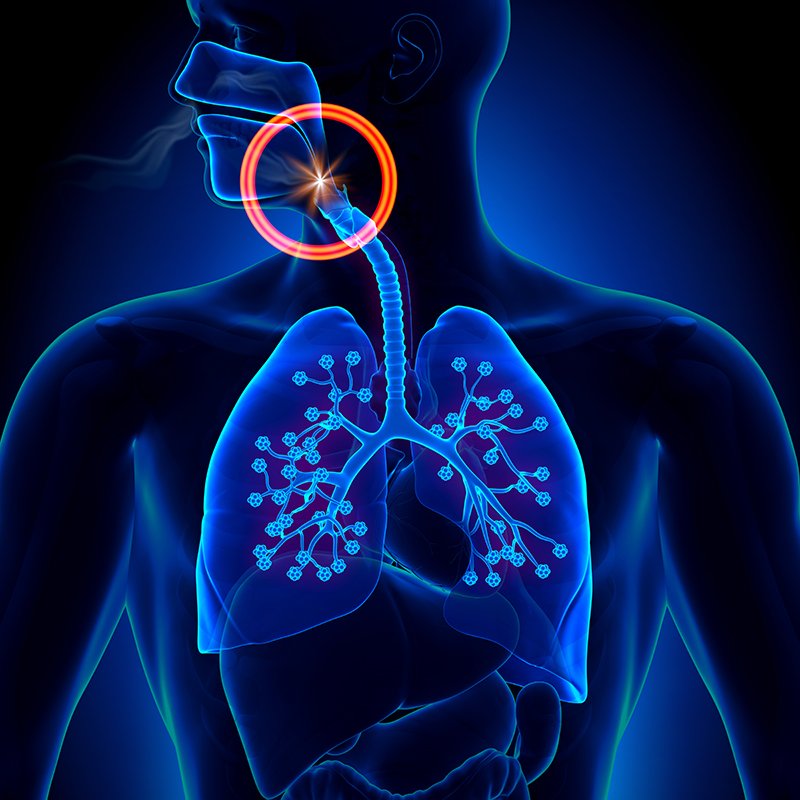 Sleep-Apnea-Diagram.jpg